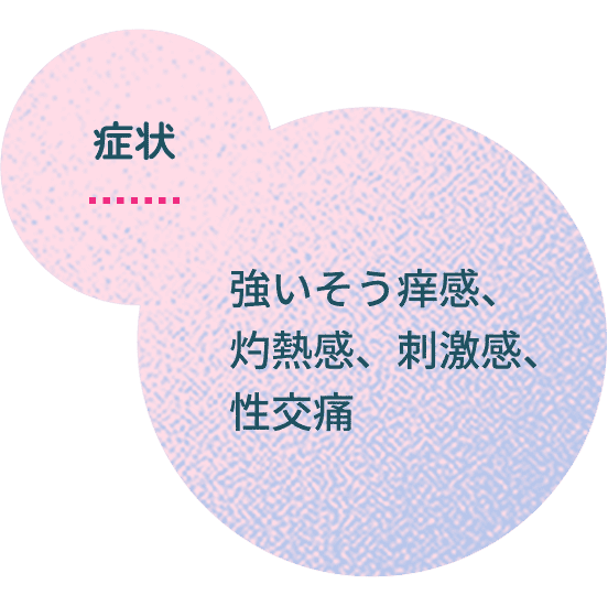 症状｜強いそう痒感、灼熱感、刺激感、性交痛