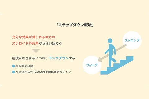 ステロイド外用剤の選び方と正しい使い方