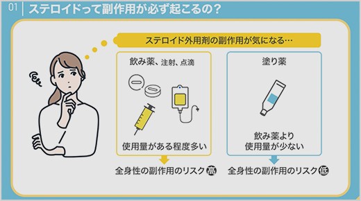 ステロイド外用剤の副作用って怖いの？