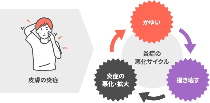 皮膚の炎症 炎症の悪化サイクル かゆい→掻き壊す→炎症の悪化・拡大
