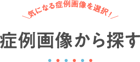 症状画像から探す ＼気になる症例画像を選択！／