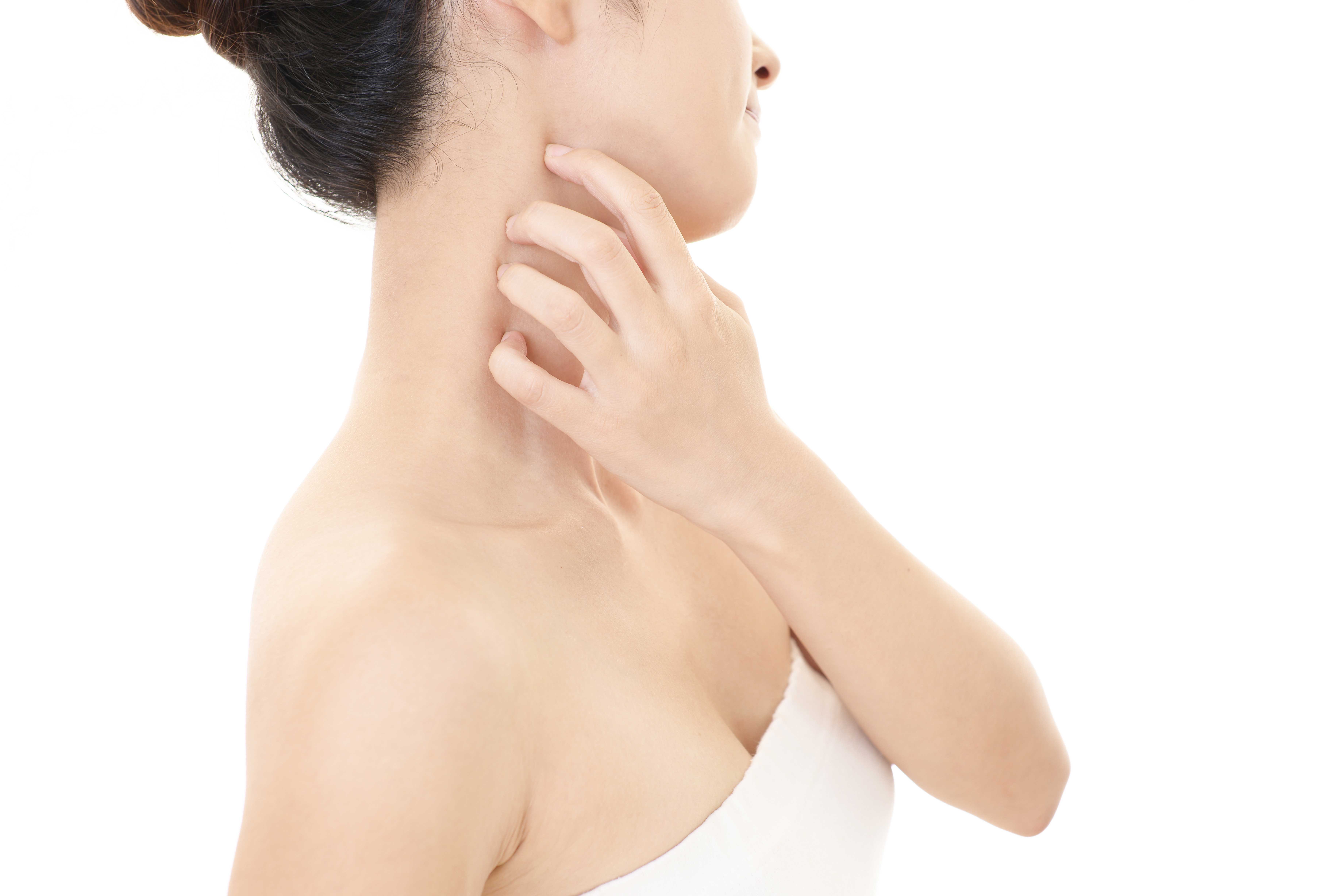 汗でカユい！それ、「あせも」だけではない？原因と対策は