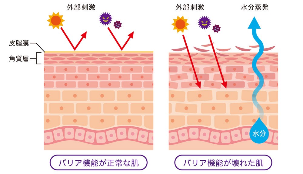 花粉皮膚炎を抑える市販薬の選び方