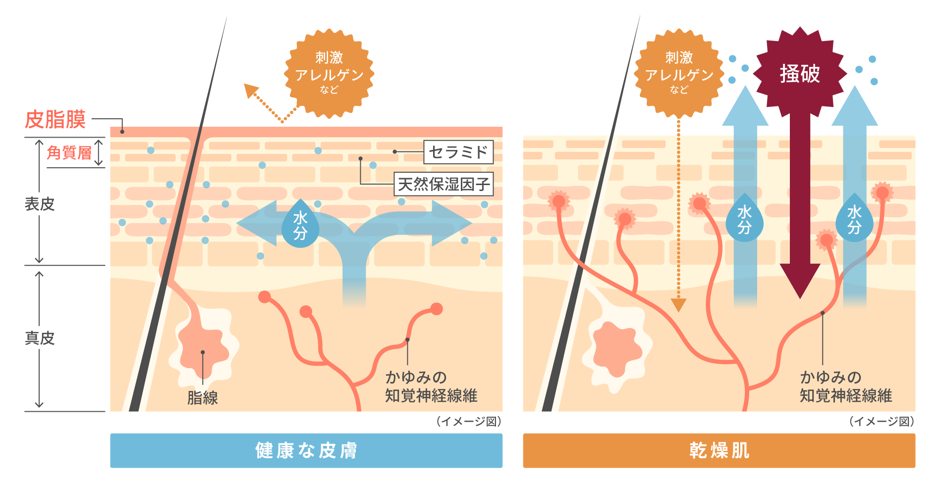 健康な皮膚と乾燥肌の皮膚の状態イメージ画像 健康な皮膚は皮脂膜と角質層によって守られていますが、乾燥肌はそれらが機能していないためかゆみの知覚神経が刺激されます