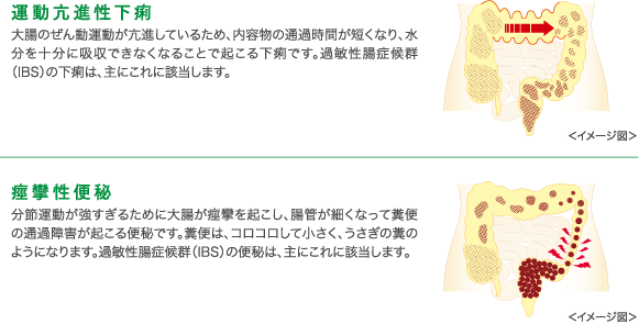 IBSにより下痢と便秘が起こるメカニズムの画像