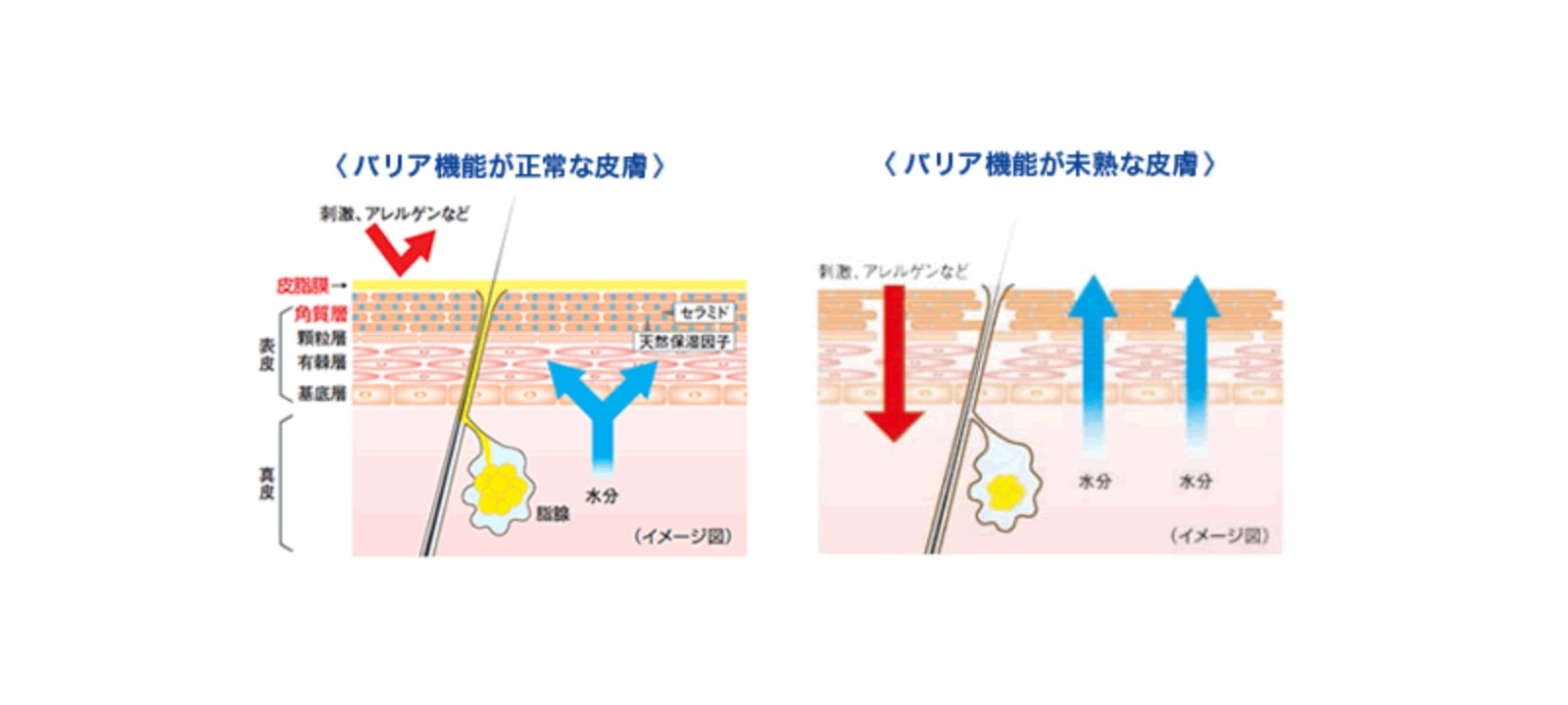 皮膚のバリア機能が正常な場合と未熟な場合の図