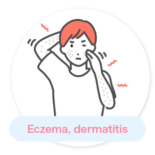 Eczema, dermatitis