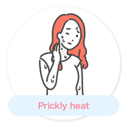 Prickly heat