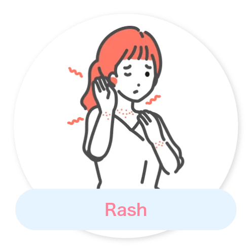 Rash