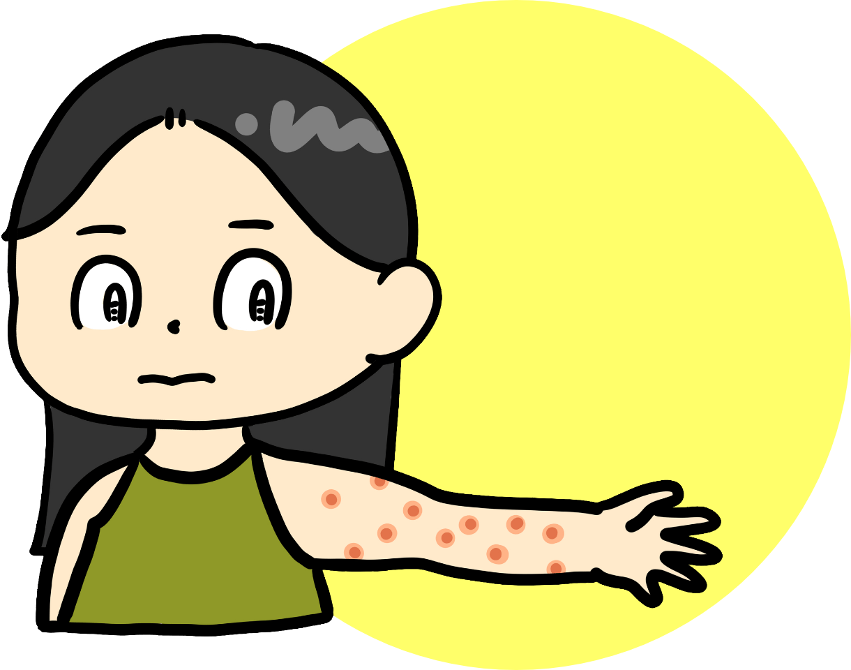 手に湿疹ができた子どものイラスト