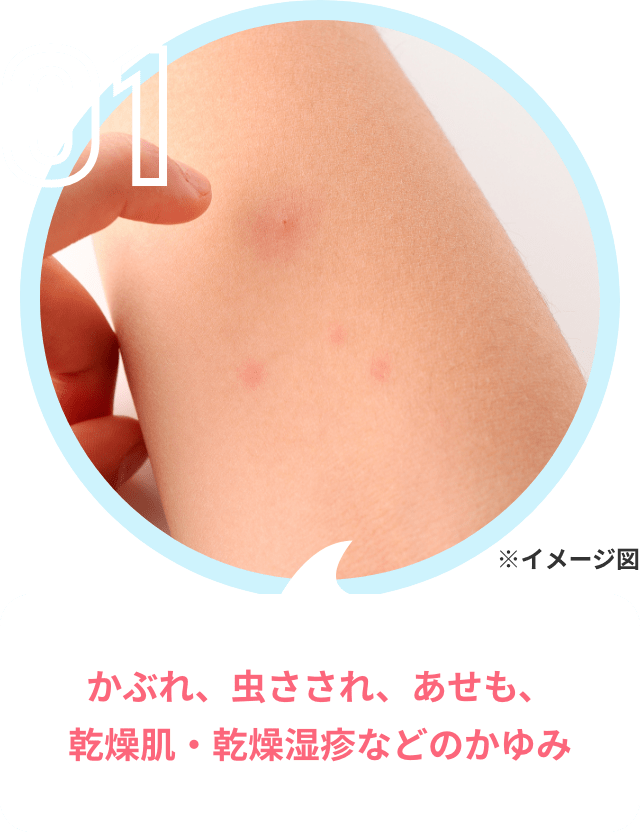 かぶれ、虫さされ、あせも、乾燥肌・乾燥湿疹などのかゆみ