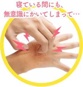 寝ている間にも、無意識にかいてしまって…