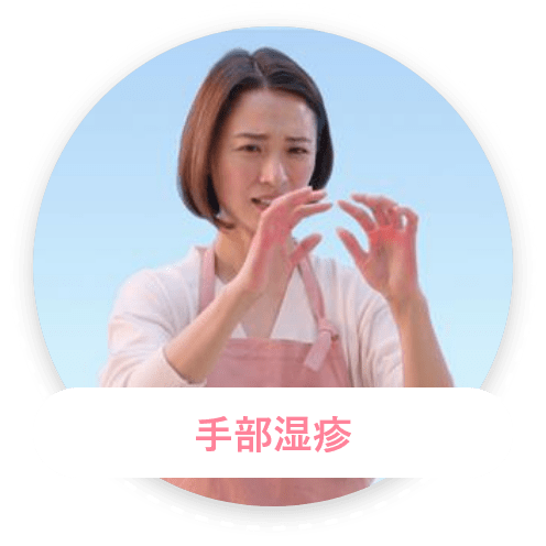 手部湿疹