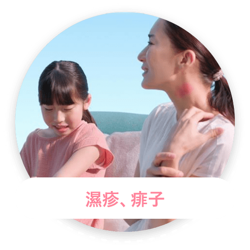濕疹、痱子