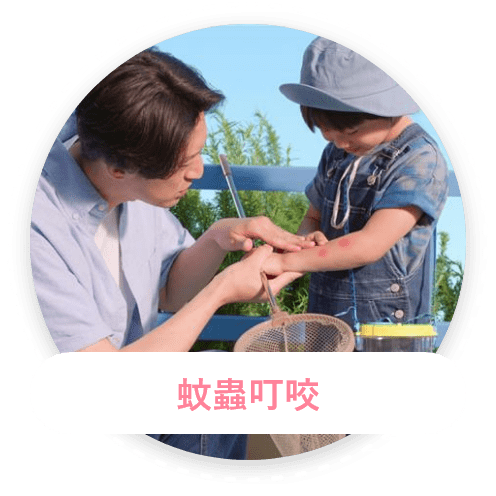 蚊蟲叮咬