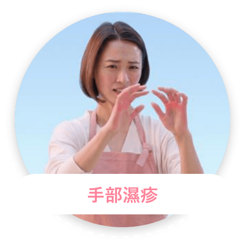 手部濕疹
